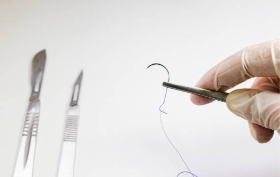 Braided Non-Absorbable Sutures