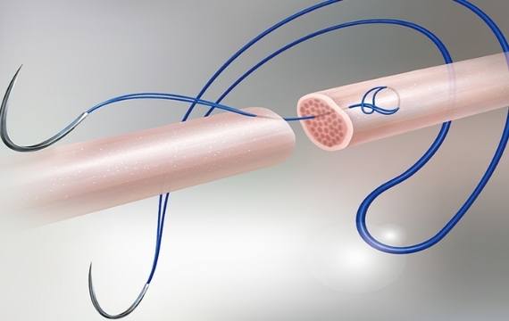 Mechanism of Action