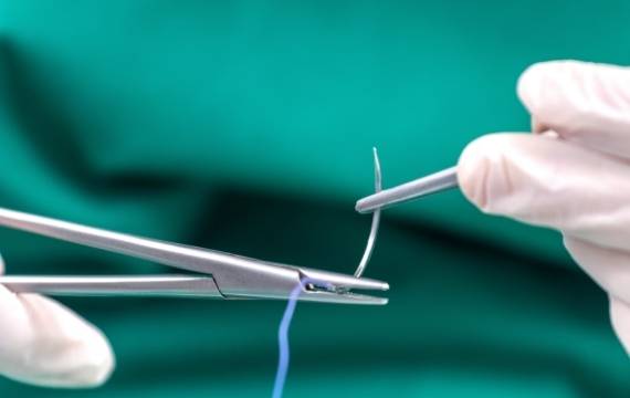 Performance of Polyester Sutures