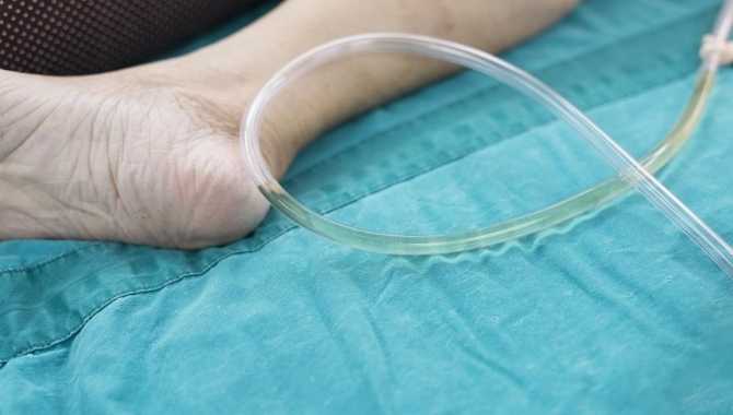 Uses of Foley Catheter