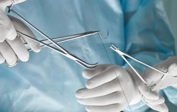 Why Choose Medico for Your Reverse Cutting Suture Needle